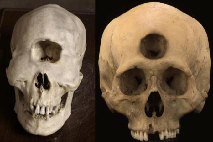 Mysterious Skulls Have Been Discovered Around The World.